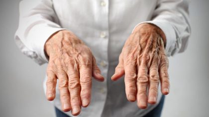 Pourquoi les veines deviennent visibles ou bombées dans les bras et les mains ?