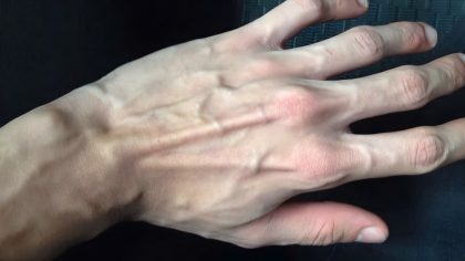 Pourquoi mes veines sont-elles si visibles ?