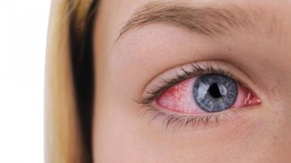8 signes avant-coureurs qui peuvent révéler un problème oculaire