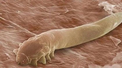 Cette minuscule créature vit dans votre corps et vous n'imaginez pas ce qu'elle peut provoquer