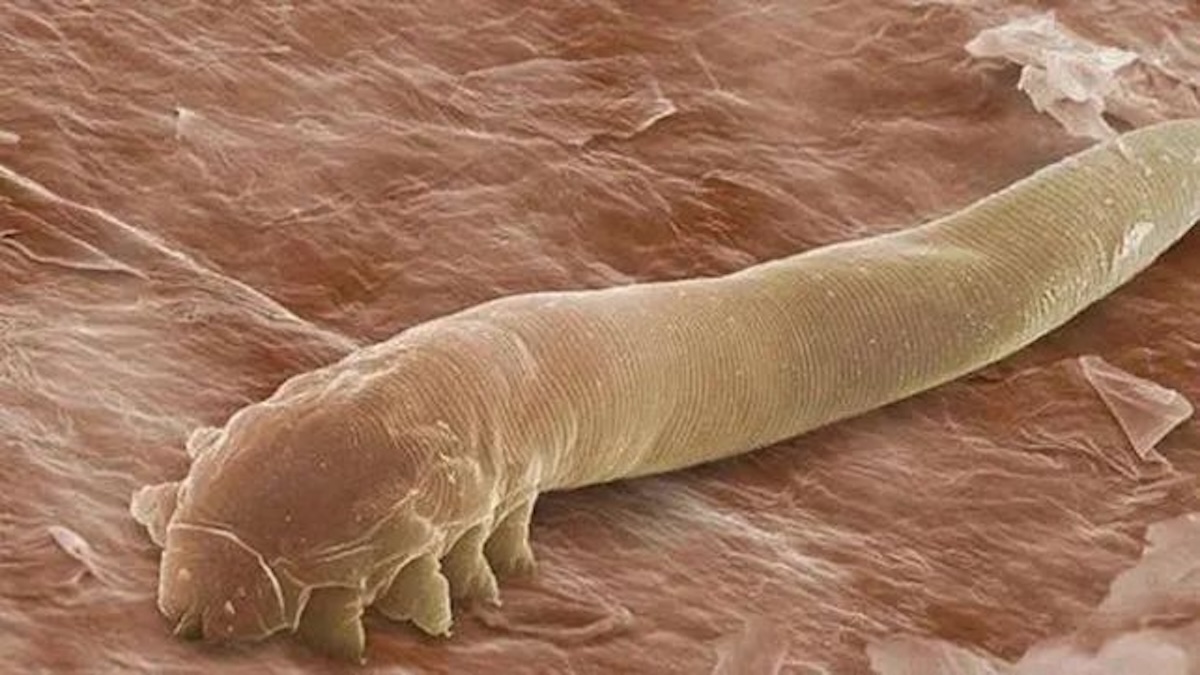 Cette minuscule créature vit dans votre corps et vous n'imaginez pas ce qu'elle peut provoquer