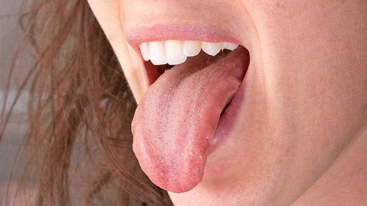 Des bosses sur la langue : quand faut-il s'inquiéter ?