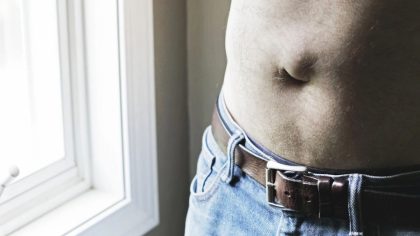 Hernie ombilicale : causes, symptômes, complications et traitement