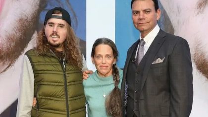 La renaissance de Cameron Underwood grâce à une greffe faciale