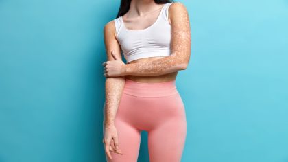 Le "Thigh Gap" ou l’écart entre les cuisses, la nouvelle tendance chez les femmes