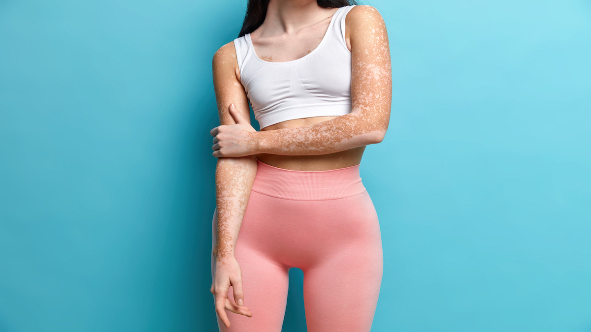 Le "Thigh Gap" ou l’écart entre les cuisses, la nouvelle tendance chez les femmes