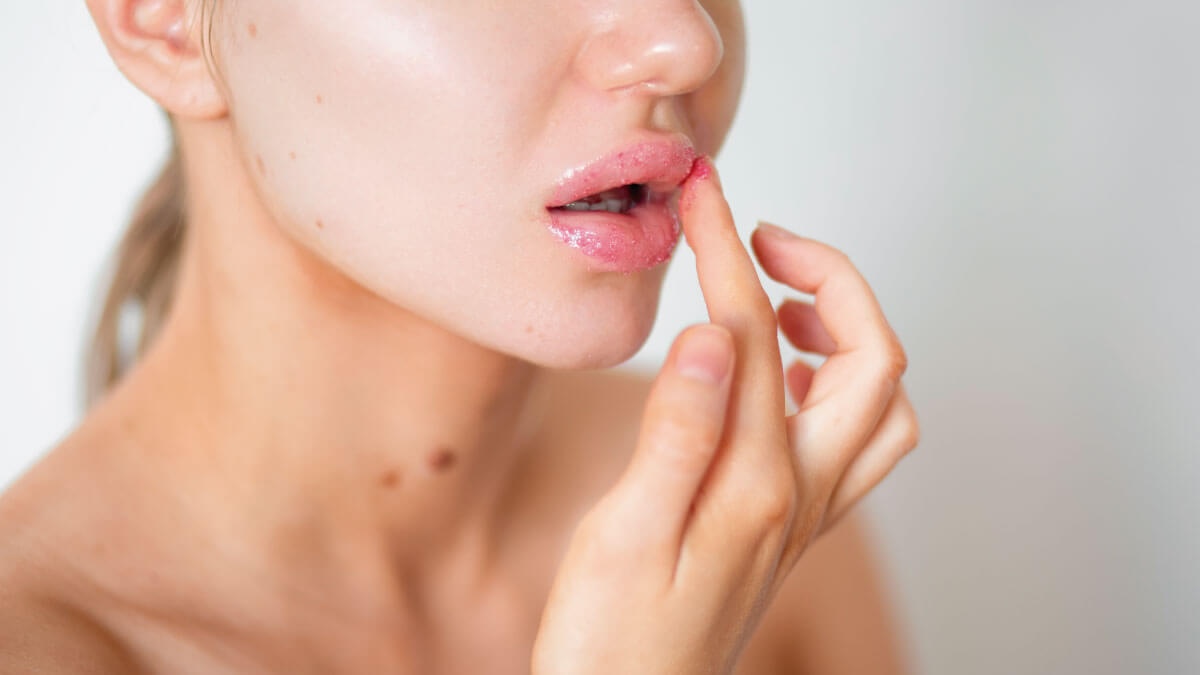 Les cloques dans la bouche peuvent être le signe de plusieurs maladies, en plus de l’herpès