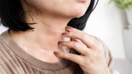 N'ignorez pas ces 5 signes, la transpiration pourrait affecter votre peau, soyez prudent