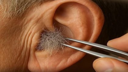 Pourquoi vous ne devriez pas épiler ou épiler vos poils d'oreilles et de nez : la science explique les effets sur la santé et comment le faire correctement