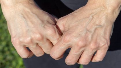 Que signifient les veines des mains et des pieds ? Indicateurs et signes avant-coureurs
