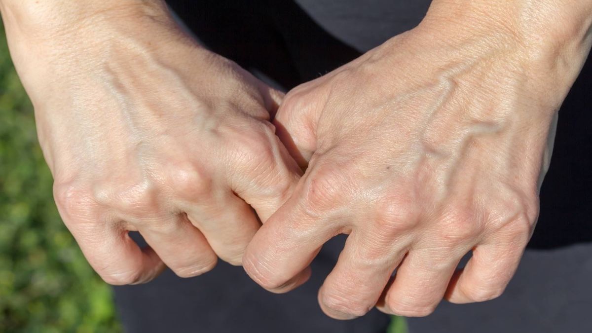 Que signifient les veines des mains et des pieds ? Indicateurs et signes avant-coureurs