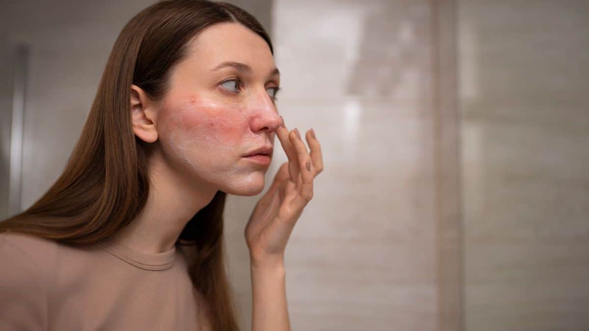 Réactions allergiques : symptômes, types et traitement