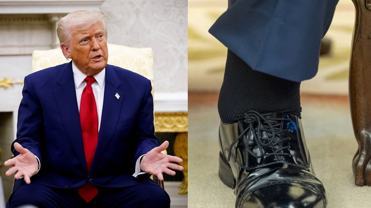 Trump souffre d’une maladie chronique qui explique pourquoi il a des ecchymoses sur les mains et des chevilles enflées